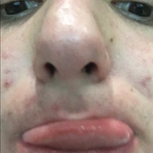 nickgargano